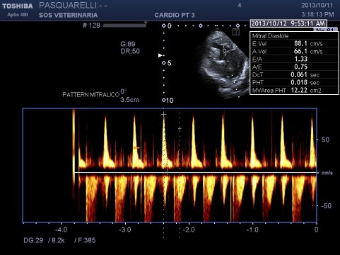 doppler mitrale pulsato 