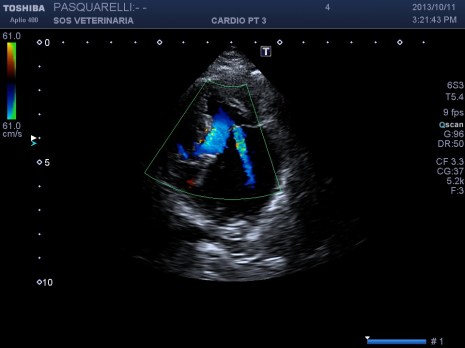 apicale color doppler 