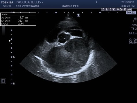 B mode asse corto parasternale destra