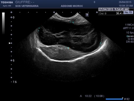 scansione retroxifoidea trasversale