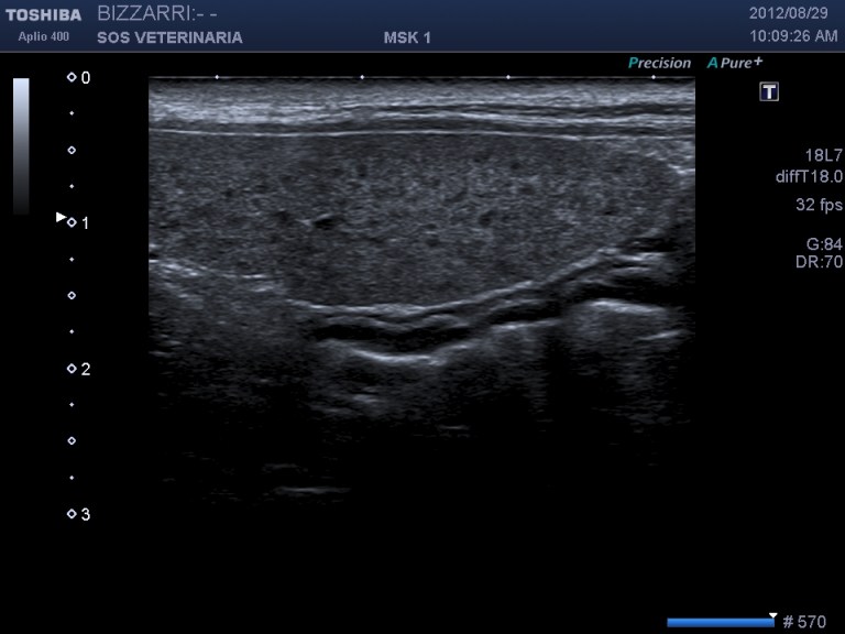milza ,le sonde ad alta frequenza evidenziano i follicoli sopratutto nei soggetti giovani il pattern non e' da confondere con quello "leopardato" evidenziabile in corso di patologie infiltrative (es linfoma)