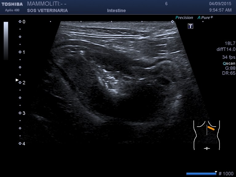 scansione trasversale