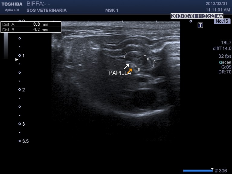 scansione sagittale paipilla