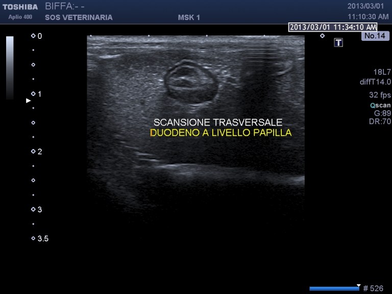 scansione trasversale papilla