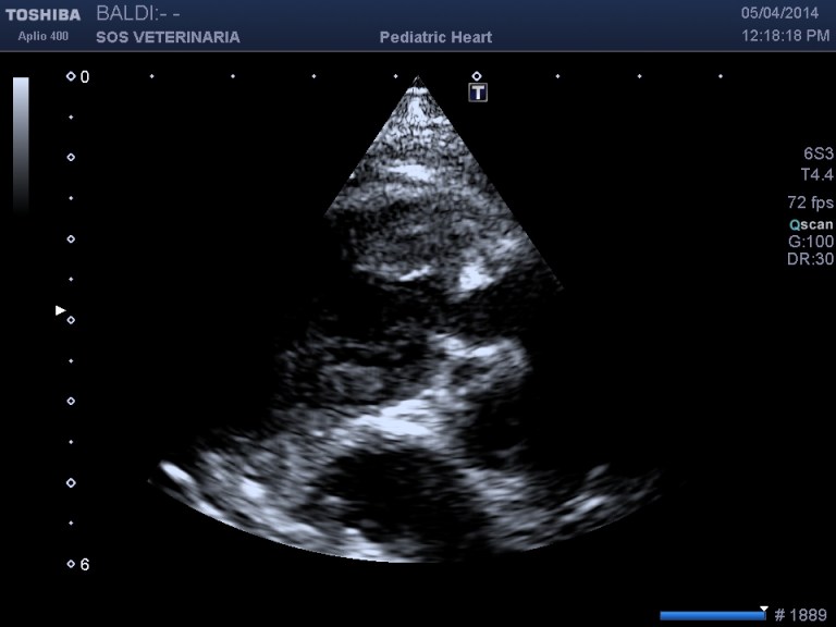 particolare stenosi asse corto sx craniale