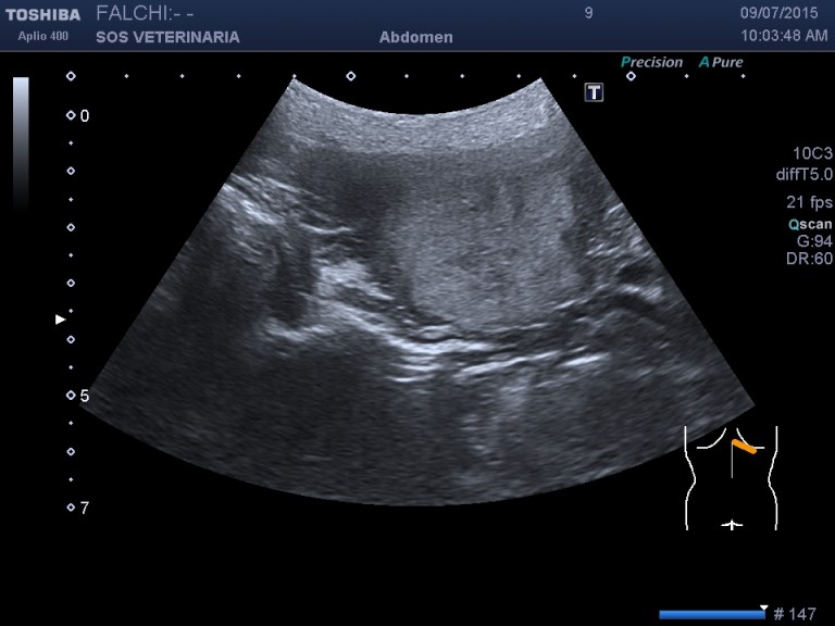 scansione trasversale