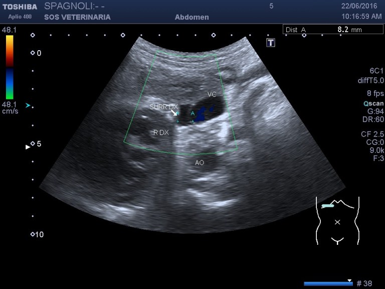 spa_surrene_dx_asse_corto1