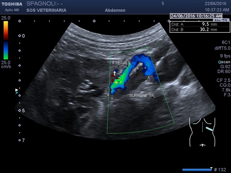 spa_surrene_sx_asse_lungo1