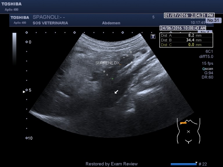 surrene-dx-asse-lungo-spagnoli
