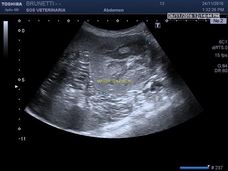 massa splenica