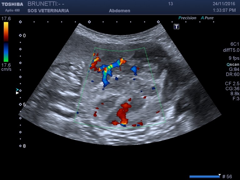 massa splenica color doppler (2)